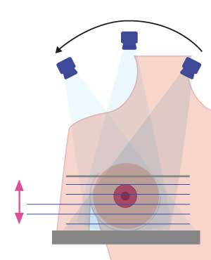 centro-diagnostico-emicenter-tomosintesi-mammaria-4