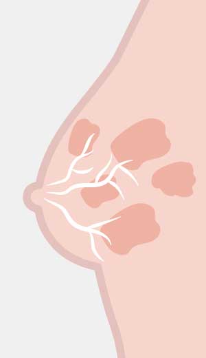 centro-diagnostico-emicenter-tomosintesi-mammaria-7