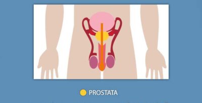 Prevenzione maschile